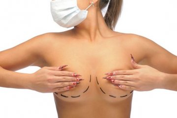 Гиперанимационная деформация груди после маммопластики. Что это такое и как исправить?