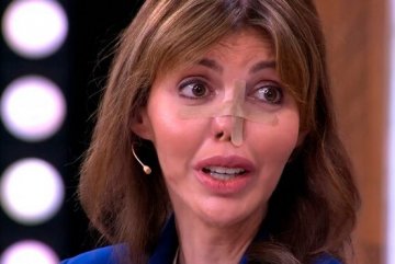 Бывшая жена Андрея Аршавина начала сложный путь по восстановлению носа