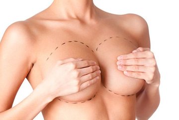 Кому необходима коррекция груди?