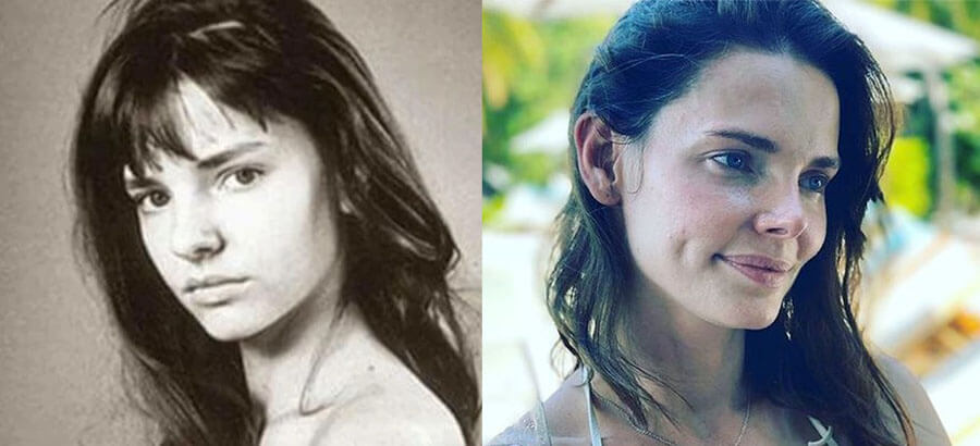 Боярская елизавета до и после пластики носа фото