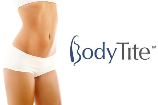 Липосакция Body Tite: новые уровень похудения и шикарной фигуры