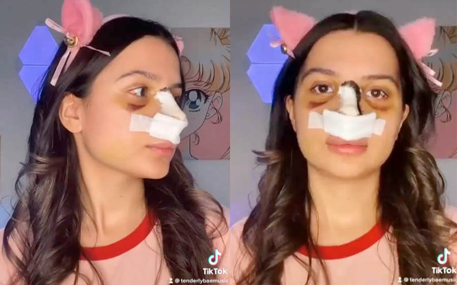 Амина без маски после операции фото до и после