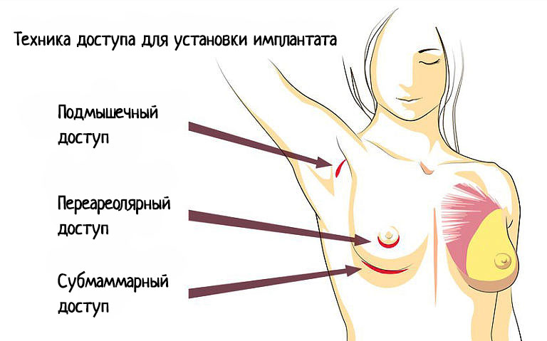 Правильный выбор разреза