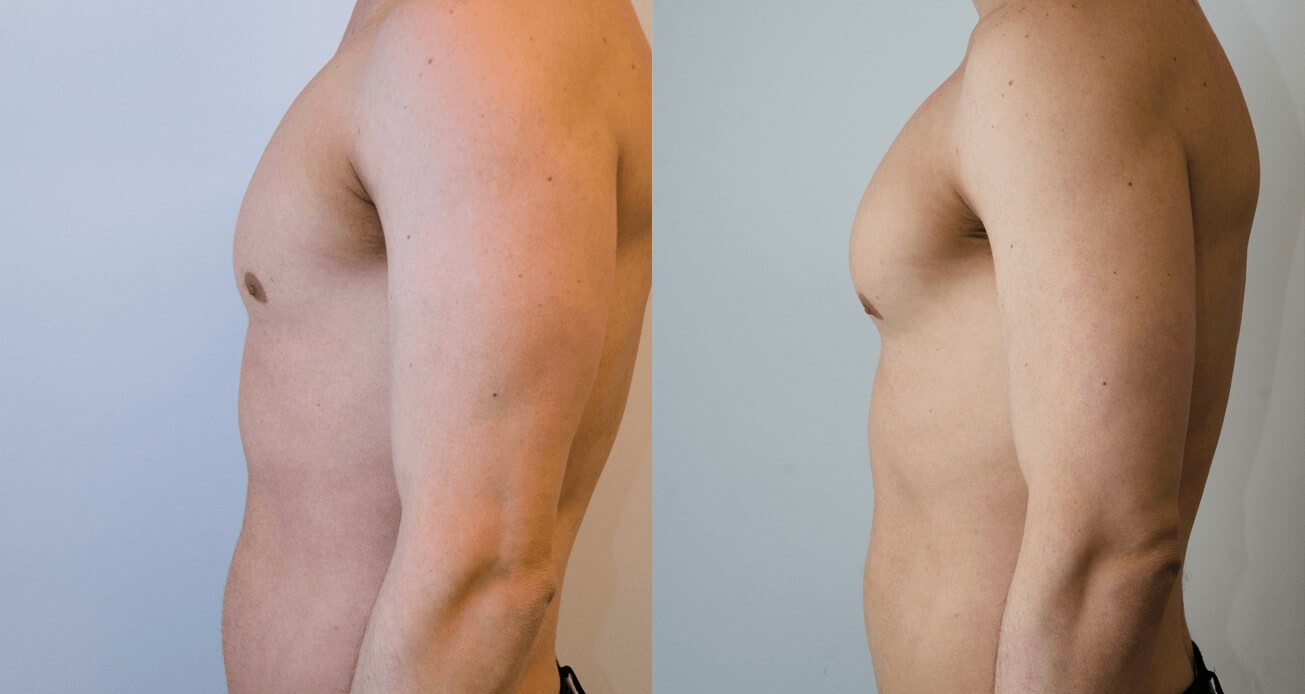 рост мышц груди у мужчин фото 27