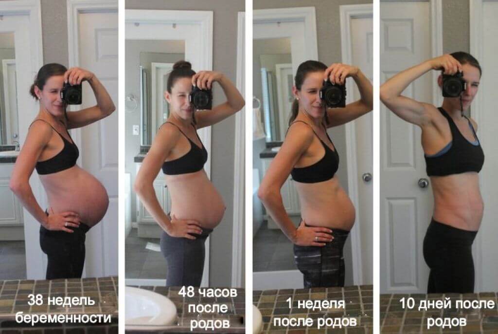 Беременность после 6 месяцев. Живот после рождения ребенка. Живот после родов в первые дни.