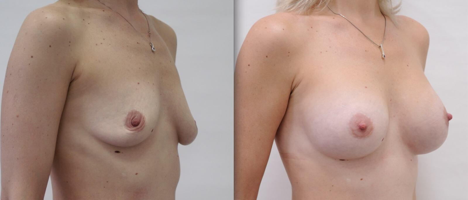 голая женщина до и после родов фото фото 21
