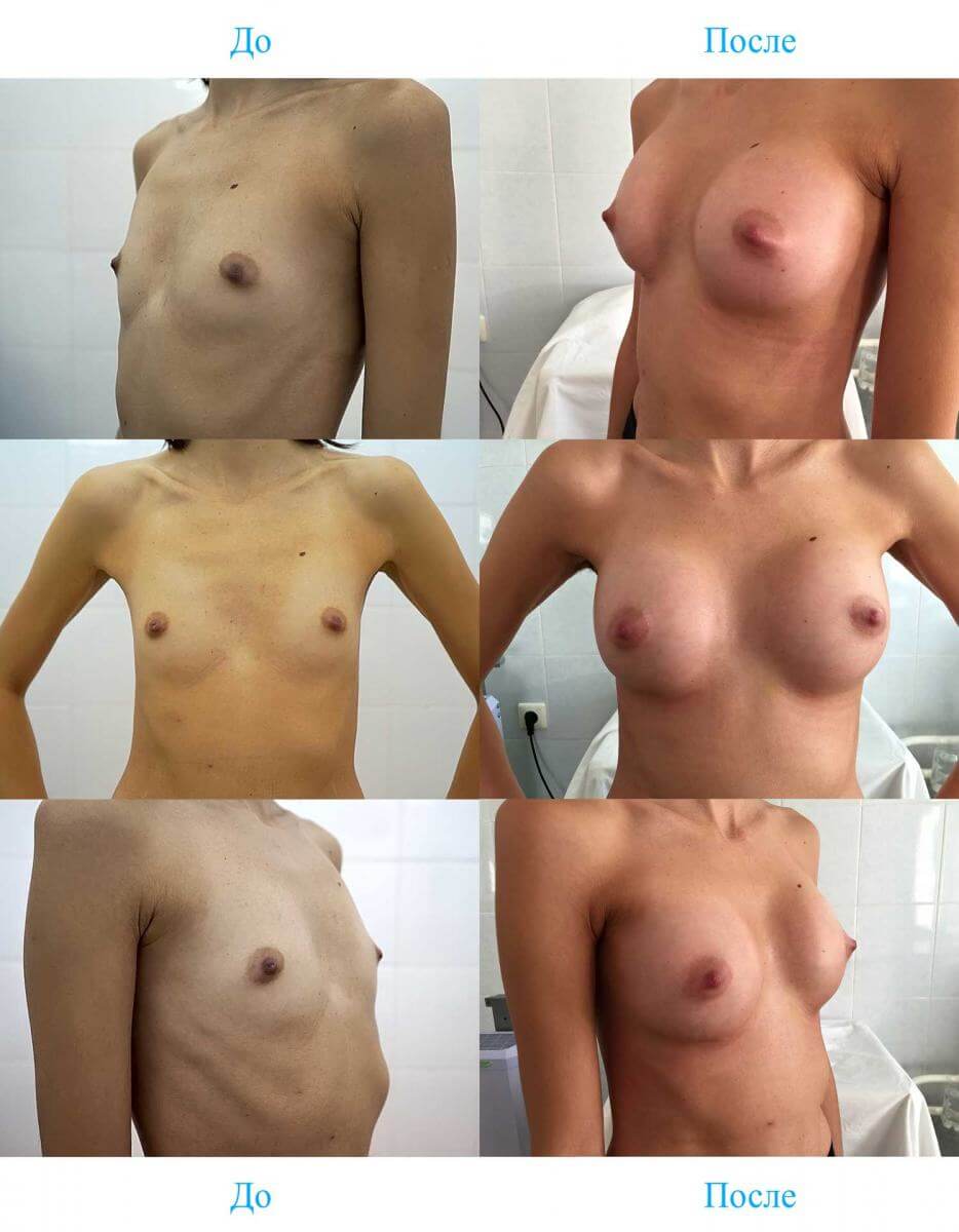 грудь не рожавших женщин фото 108