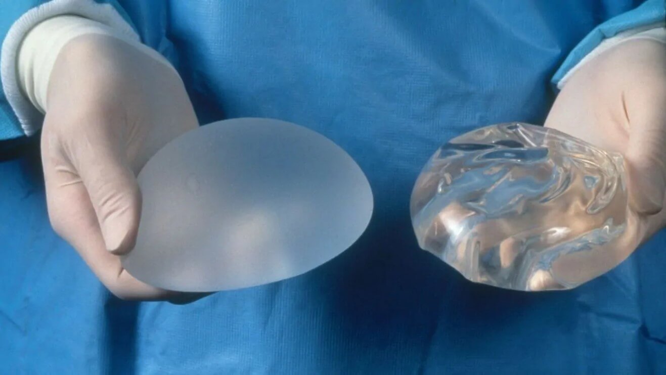 имплант силиконовый для груди (120) фото