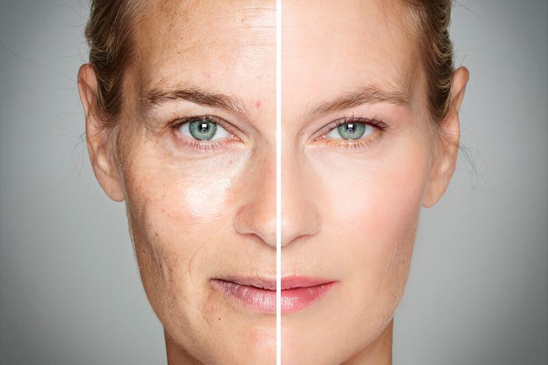 Если не защищать кожу от фотостарения, можно выглядеть на 5-10 лет старше