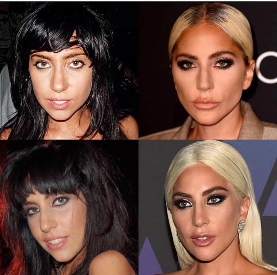 Леди Гага за годы своей карьеры сильно изменилась внешне
