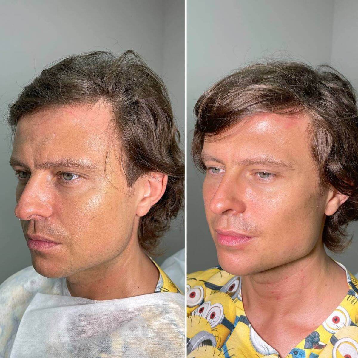 Сергей безруков пластика лица фото до и после 2020