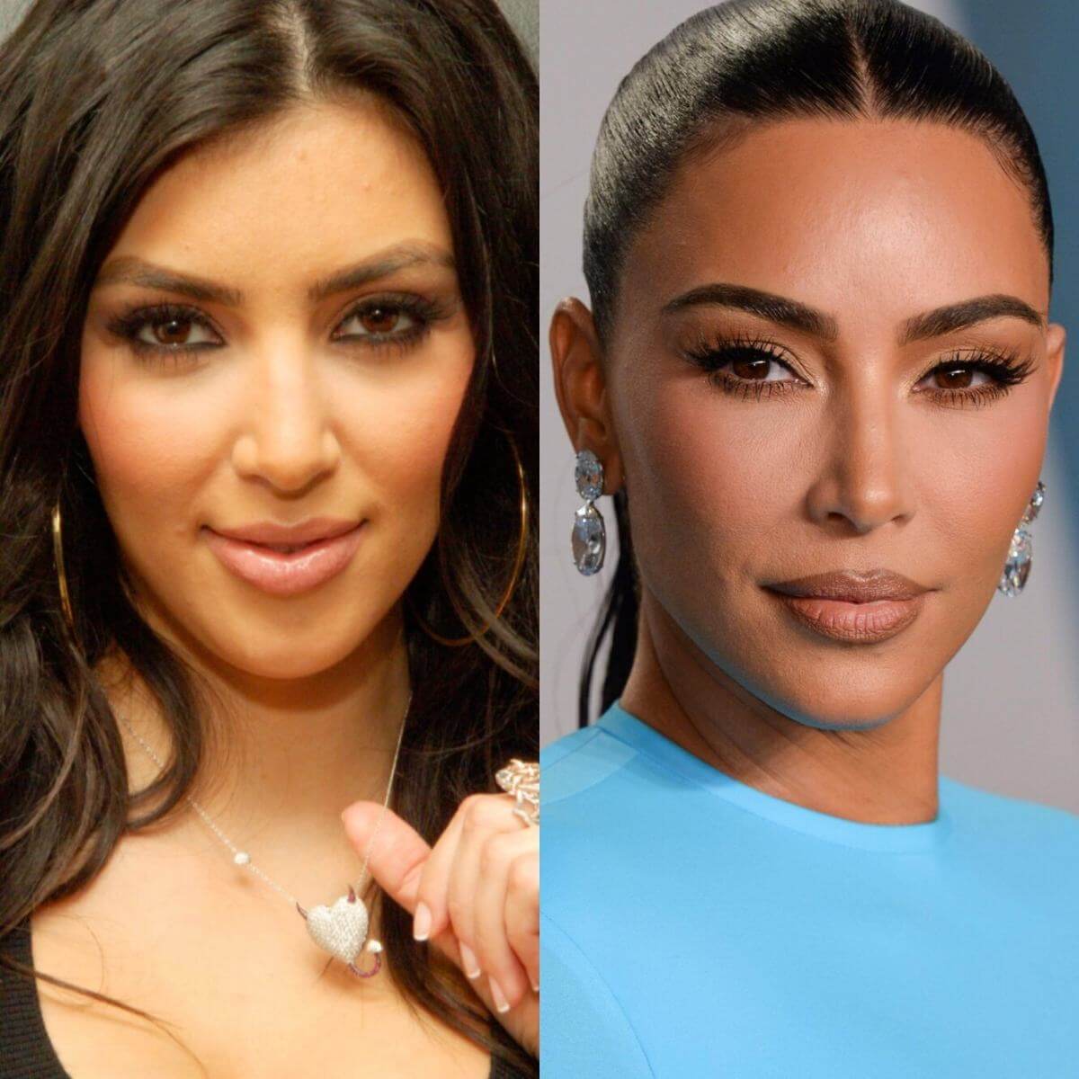 Ким Кардашьян до и после ринопластики