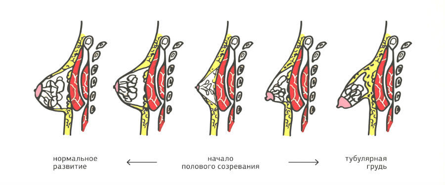 Накладки на грудь для кормления LUBBY, размер M zabota2, 2 шт. силикон 15670