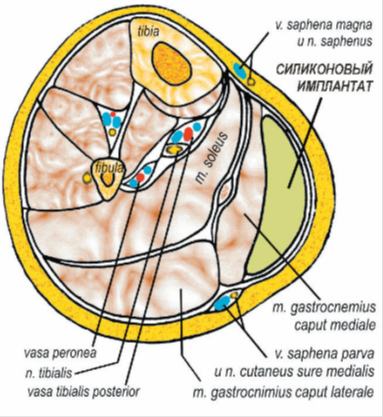 Как проходит операция