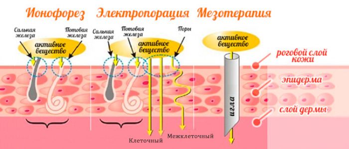 Сравнение методик