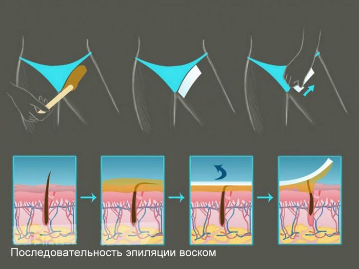 Методика удаления волос воском