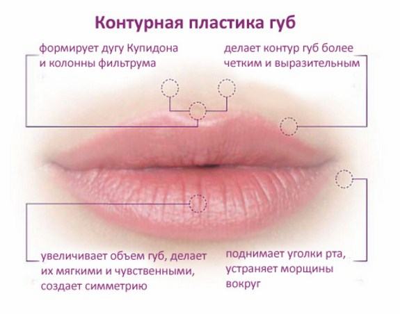 О процедуре контурной пластики губ