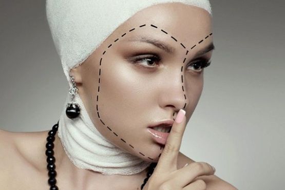 «Подтяжка манекенщицы»: как получить «модельное лицо» с помощью пластики