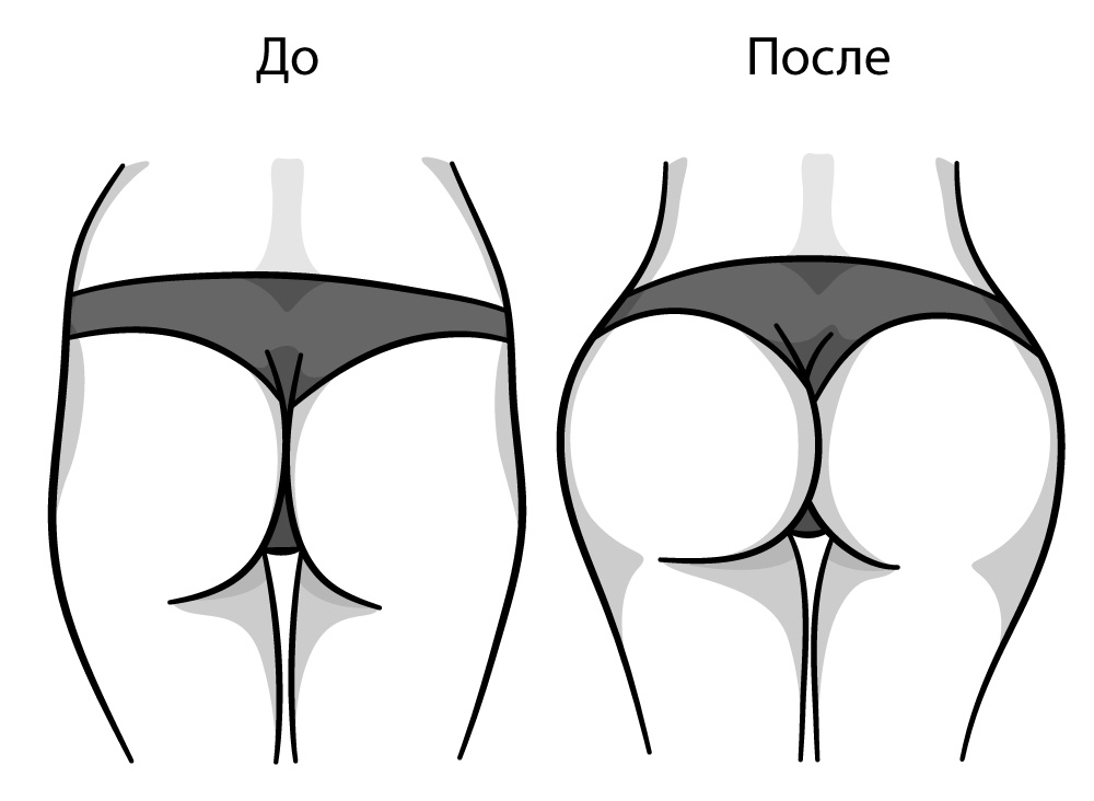 Впадины на бедрах