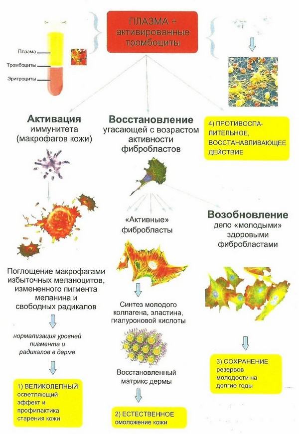 Как происходит плазмолифтинг