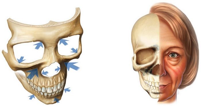 Изменение лицевого скелета с возрастом по Мендельсону
