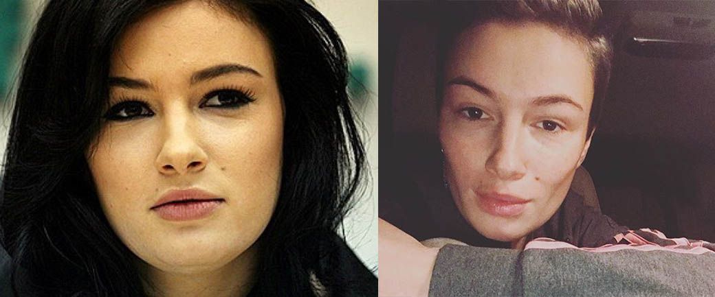 Анастасия певица фото до и после пластики
