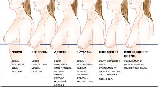 Как изменяется грудь