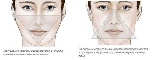 Потеря объема лица