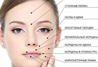 Объемная контурная пластика