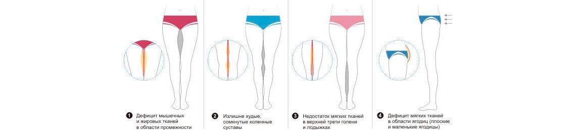 липофилинг голеней