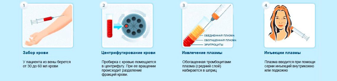 Проведение плазмолифтинга