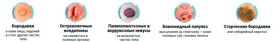 Виды новообразований на коже