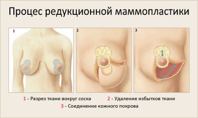 Методика проведения