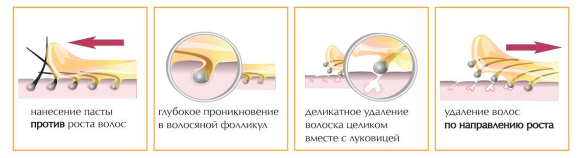 Проведение шугаринга