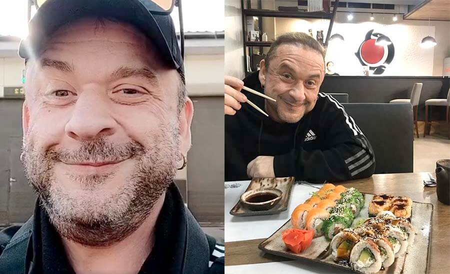 Морозов после пластики