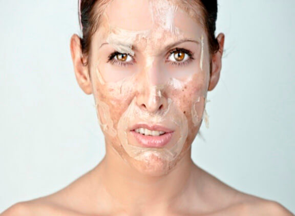 Пилинг Джесснера, что это?