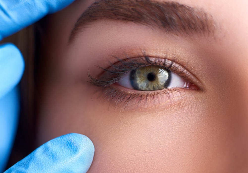 ТОП-лифтинг и кому он подойдет?