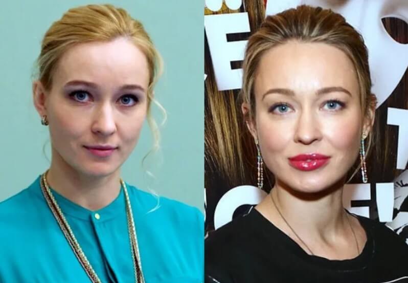 Анастасия Панина пластика губ