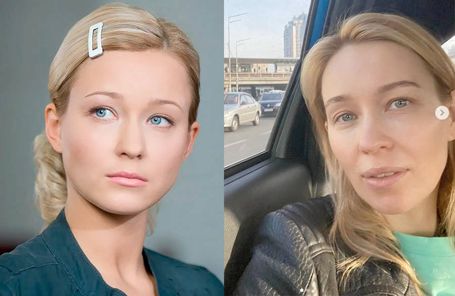 Анастасия Панина до&nbsp;и&nbsp;после пластики