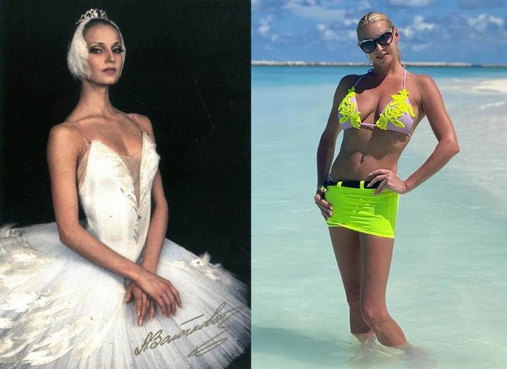 Анастасия Волочкова до после