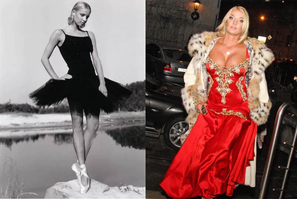 Анастасия Волочкова грудь до и после