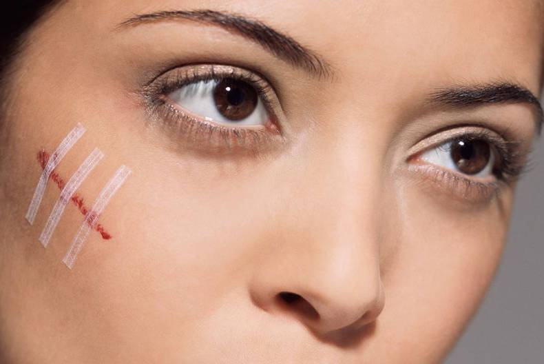 Ботокс для лица от шрамов и травм