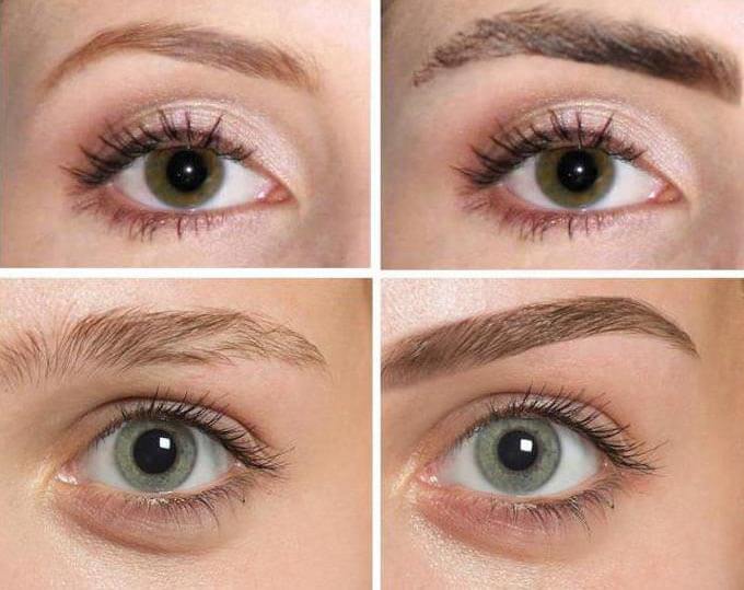 Фото до&nbsp;после пересадки