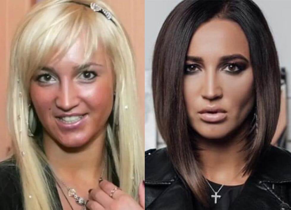 Ольга Бузова скулы