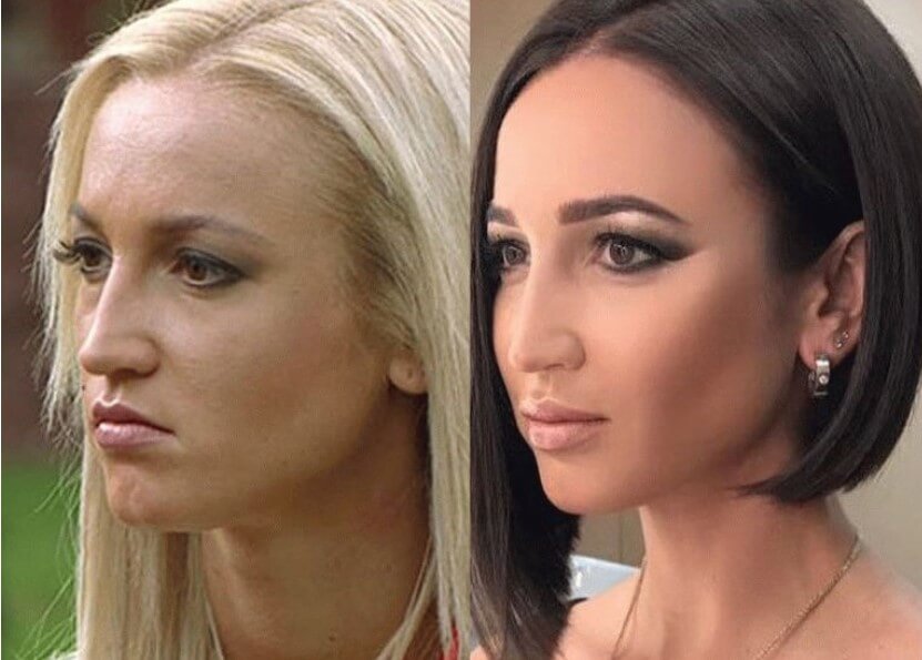 Ольга Бузова нос