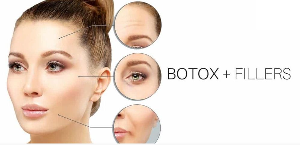 Сочетание ботокса и&nbsp;филлеров