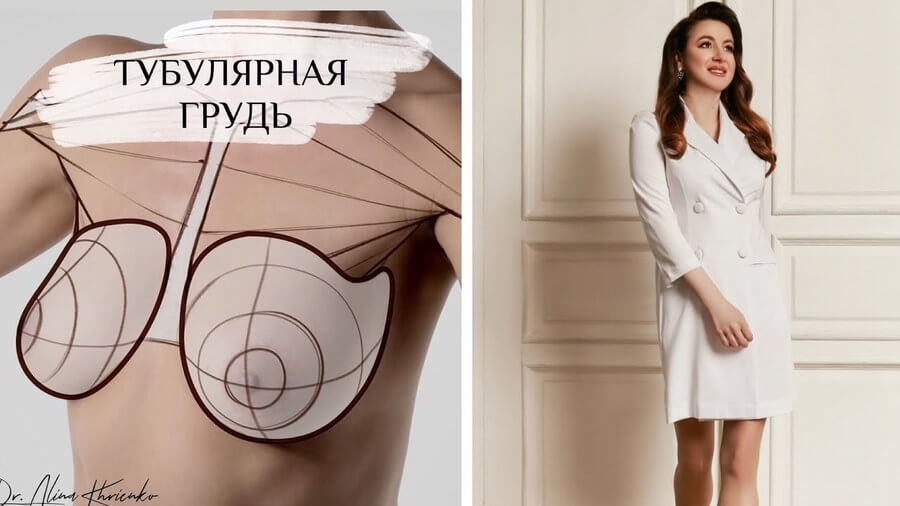 Красивая грудь и тубулярная грудь