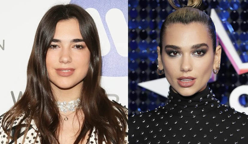 Дуа Липа ринопластика