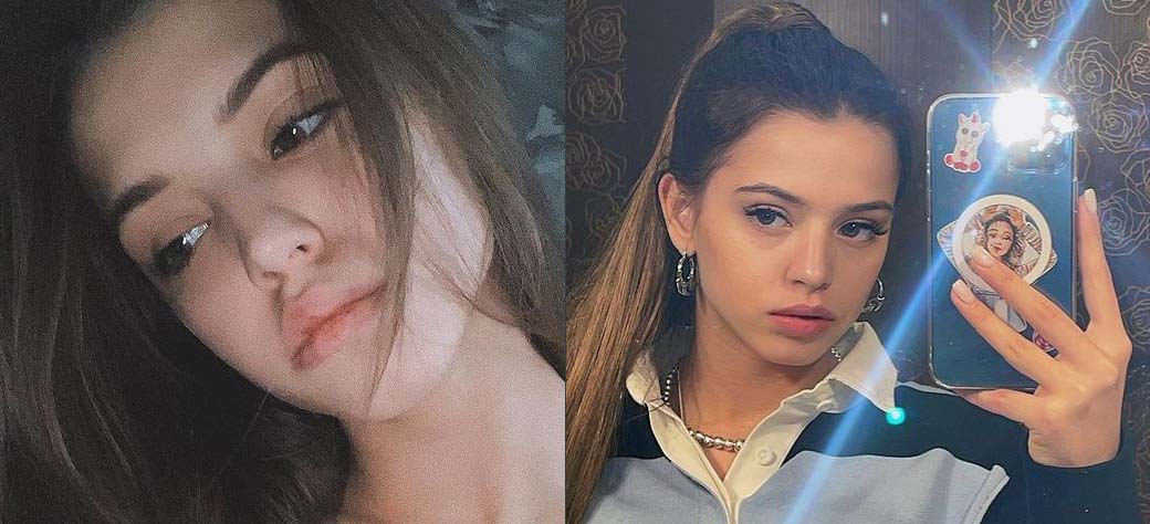 Юлия Гаврилина до и после пластики