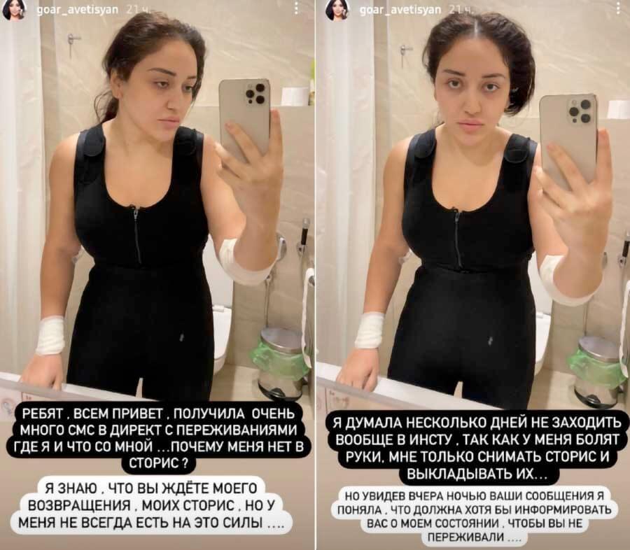 Гоар Аветисян 2021 пластика